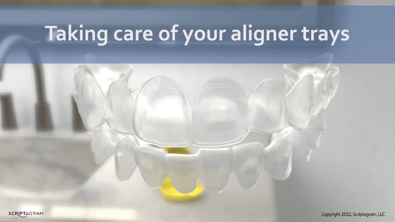 <strong>Taking Care of Your Aligner Trays</strong>