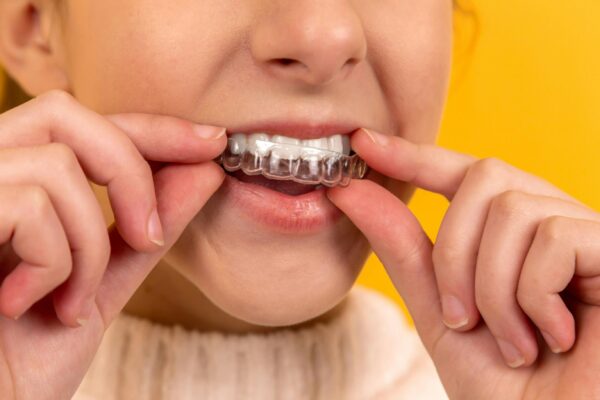 Invisalign Treatment in Griffin GA: Top Benefits You Should Know